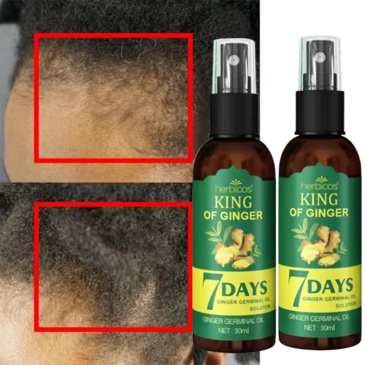 Wholesale Factory Price Hair Regrowth Oil OEM/ODM Private Label Hair Treatment Lotion Spray Anti-Hair Loss Repairing Features